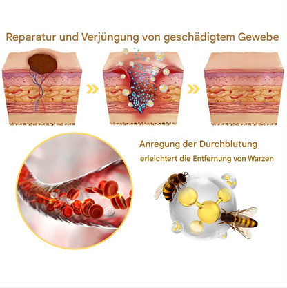 TagAway™ – Plantaardige Wrat & Huidtag Verwijdering | 1 + 1 Gratis