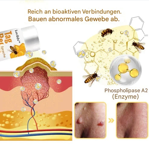 TagAway™ – Plantaardige Wrat & Huidtag Verwijdering | 1 + 1 Gratis
