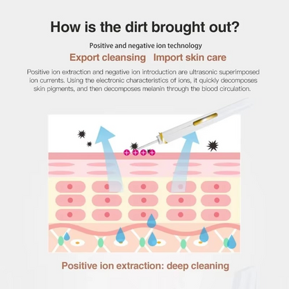 SkinSonic™ – Ultrasone Skin Scrubber voor Diepe Poriënreiniging & Stralende Huid