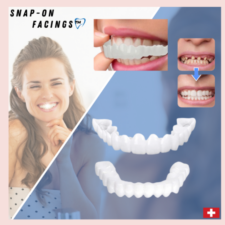 BrightSmile™ - Snap-on prothese voor een perfect witte glimlach [1 + 1 Gratis]