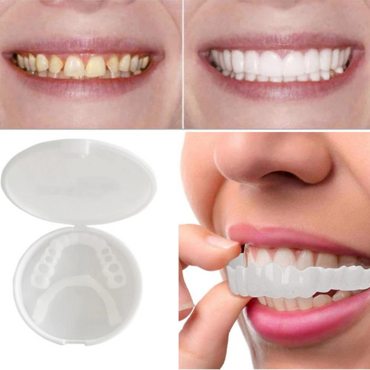BrightSmile™ - Snap-on prothese voor een perfect witte glimlach [1 + 1 Gratis]
