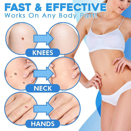 DermFree™ – Pijnloze, zachte en effectieve verwijdering [50% Korting]