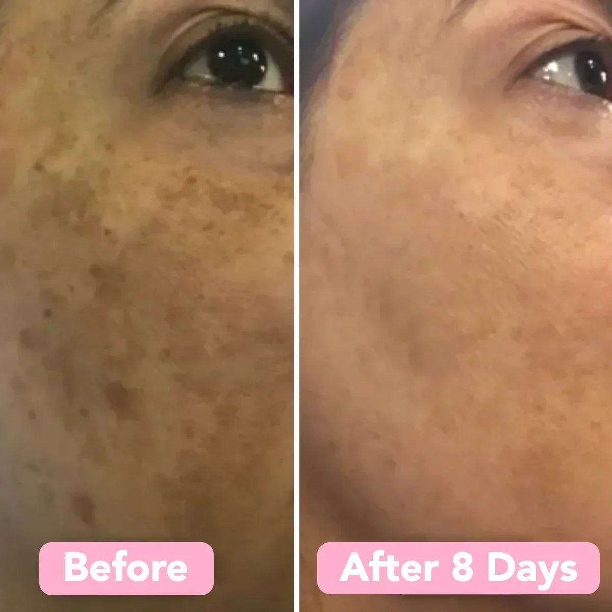 GlowPurify™ – Stralende Huidvernieuwing & Dieptereiniging [50% Korting]