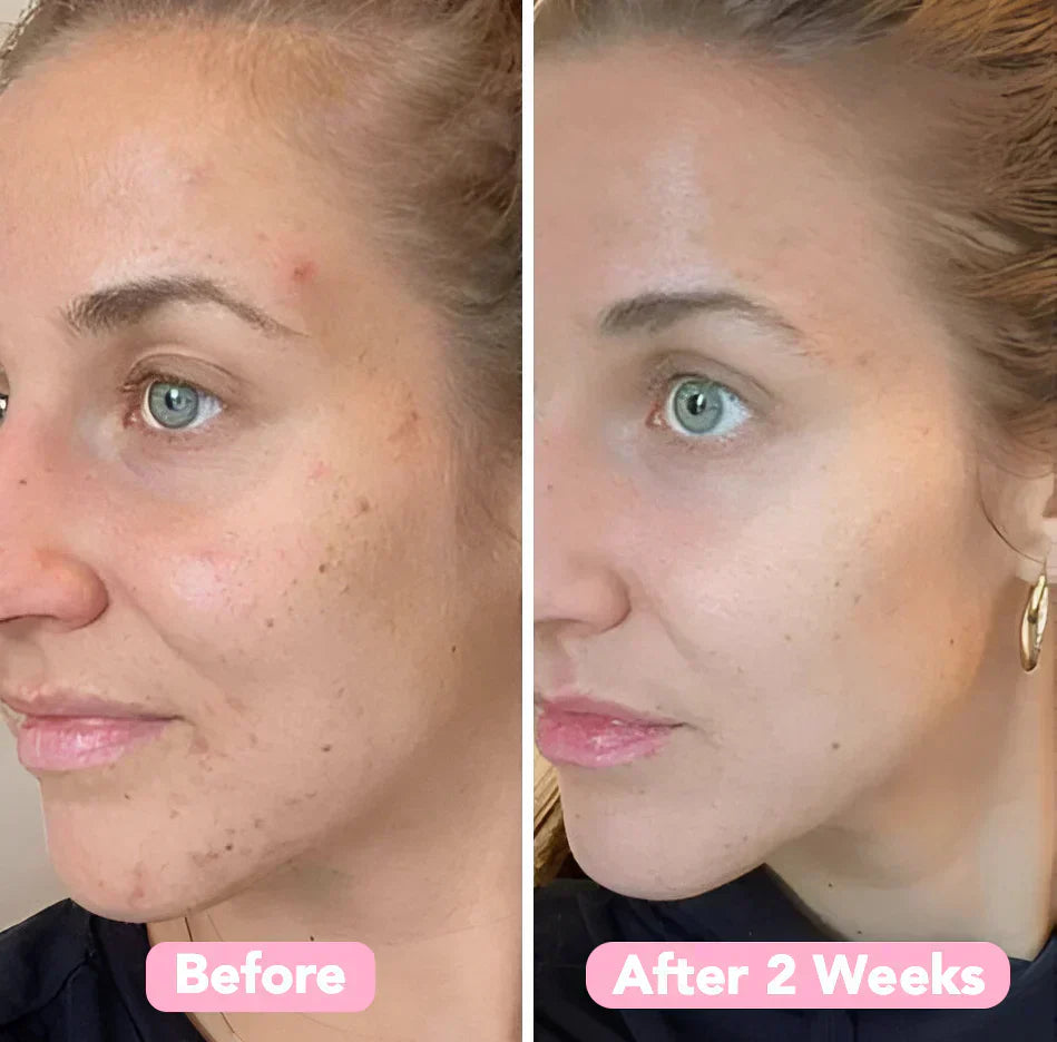 GlowPurify™ – Stralende Huidvernieuwing & Dieptereiniging [50% Korting]