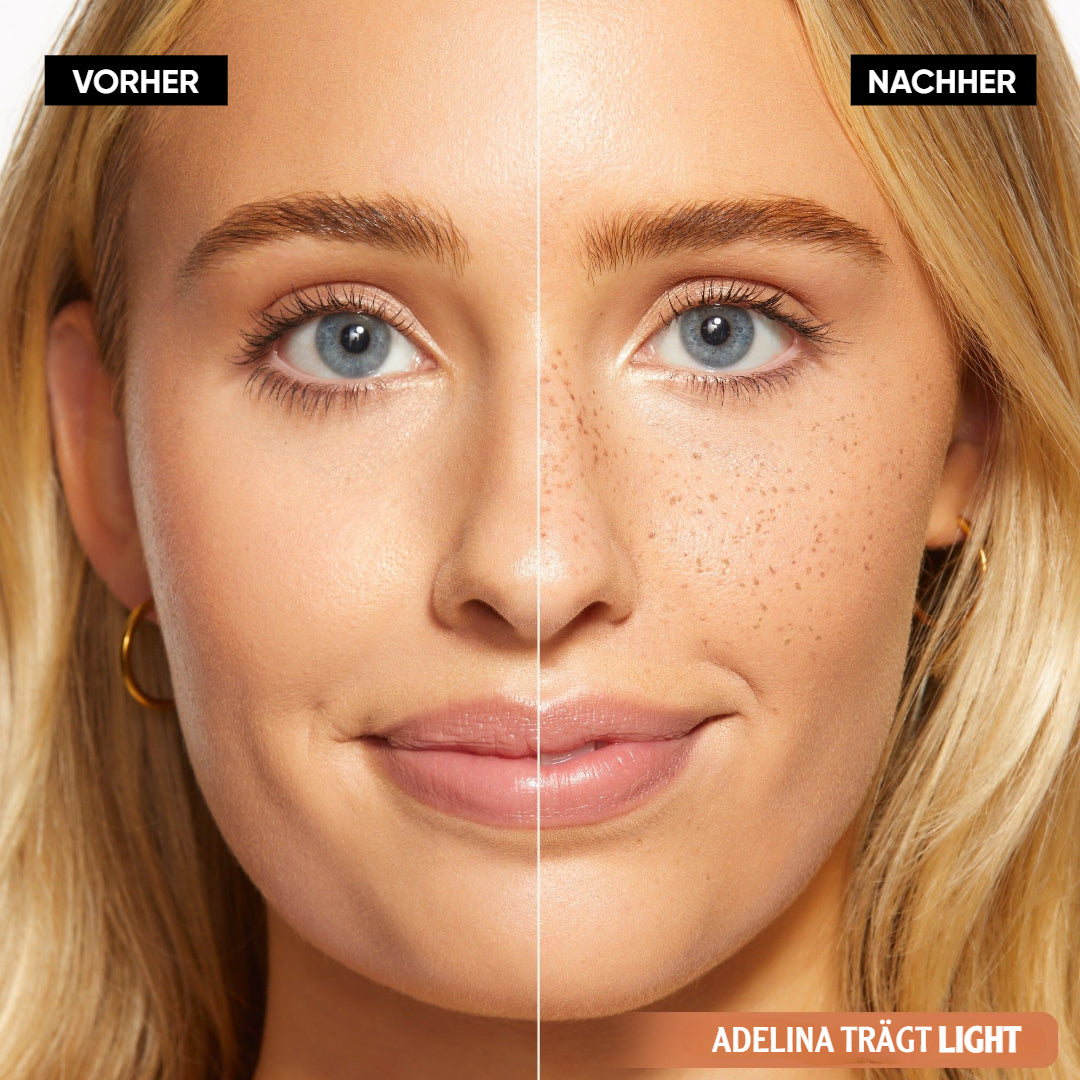 SpeckleTouch™ – Speels & opvallend beauty-accent [50% korting]