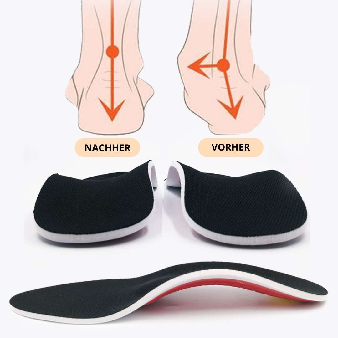 ArchEase™ Orthopedische Inlegzolen – Verlichting van Voet- en Gewrichtspijn