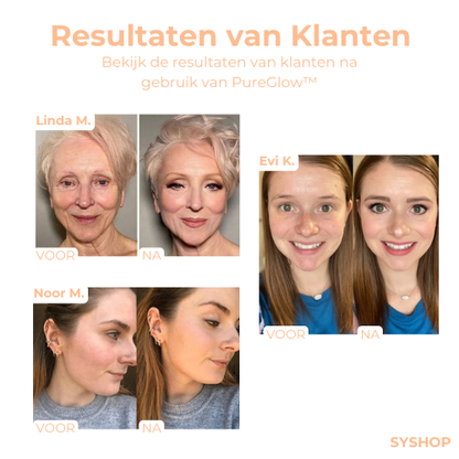 PureGlow – Voor stralend mooie huid die overtuigt [1 + 1 Gratis]