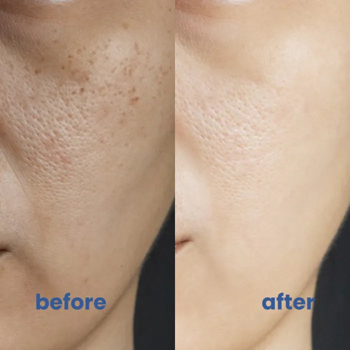 BrightSkin™ – Kalmerende verzorging voor een perfecte, stralende huid [1 + 1 Gratis]