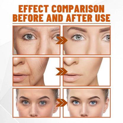 CollagenMask™ – Voor geregenereerde, stralend mooie en jeugdige, frisse huid [50% Korting]