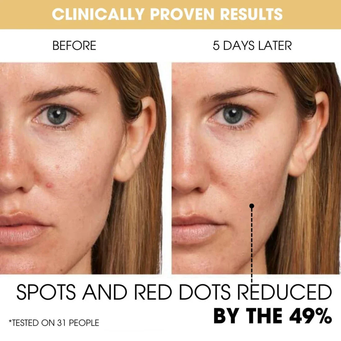 MediCube™ - Zichtbare glans en een goed gehydrateerde huid! [1 + 1 Gratis]