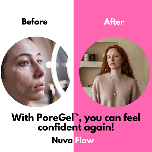 PoreGel™ – Poriëverwijderende primer voor een vlekkeloze, gladde en stralende huid [1 + 1 Gratis]