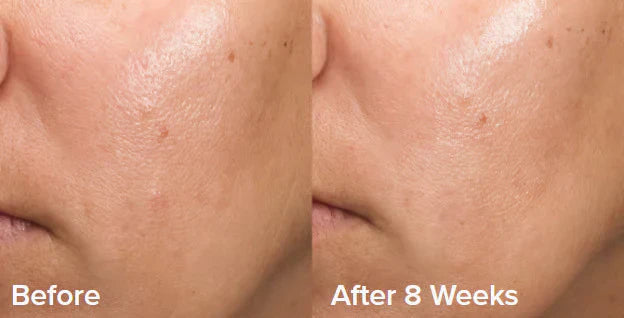 GlowEssence™ – De enige peelinggel die je nodig hebt voor een gladde en stralende huid [50% Korting]