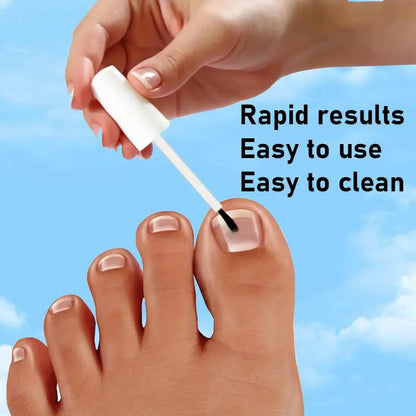 NailVive™ Nagelserum – Sterke & Gezonde Nagels met Keratine & Aloë Vera