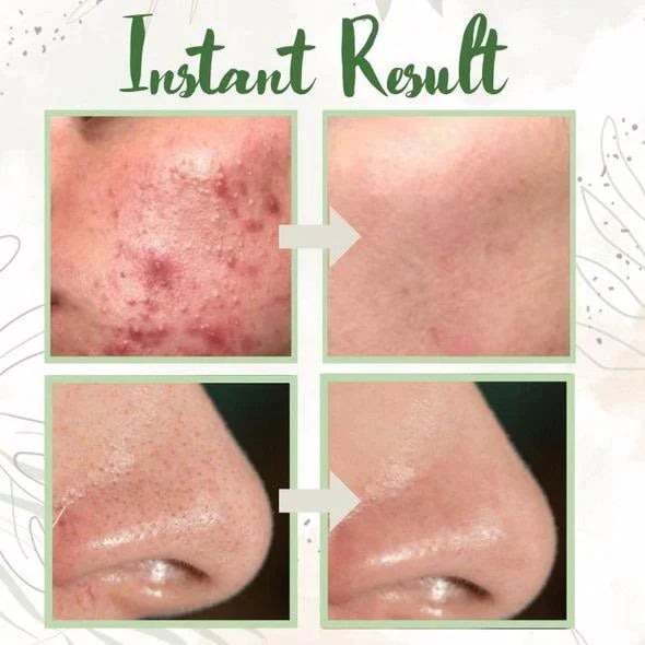 GreenTea™ - Groene thee diep reinigend masker [1 + 1 Gratis]