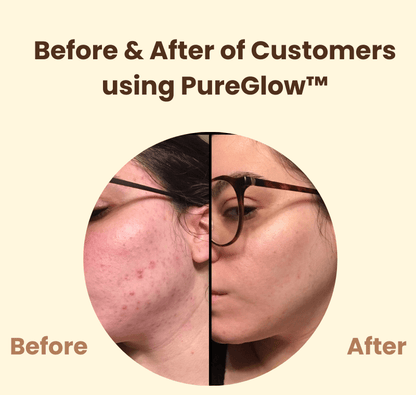 PureGlow™ – Natuurlijke uitstraling en hernieuwd, stralend zelfvertrouwen [50% Korting]