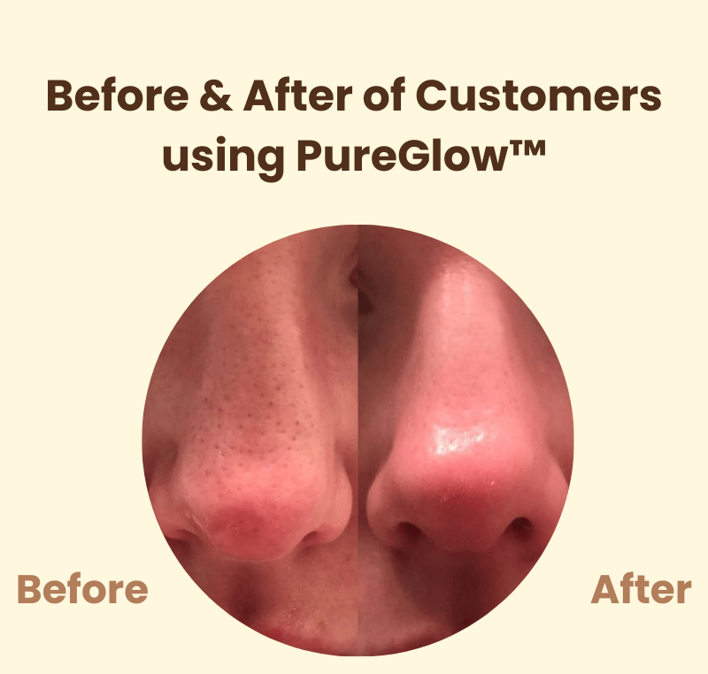 PureGlow™ – Natuurlijke uitstraling en hernieuwd, stralend zelfvertrouwen [50% Korting]