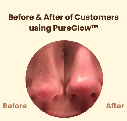 PureGlow™ – Natuurlijke uitstraling en hernieuwd, stralend zelfvertrouwen [50% Korting]
