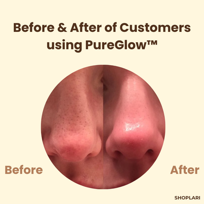 PureGlow™ – Zwarte thee & ginseng tegen acne, rimpels & onzuiverheden voor een stralende huid [1 + 1 Gratis]