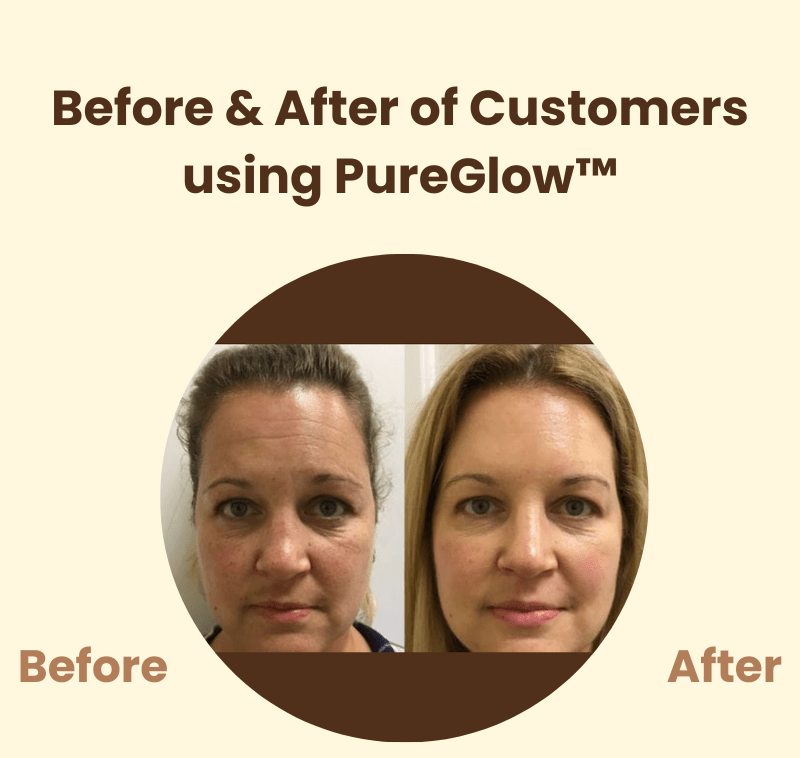 PureGlow™ – Natuurlijke uitstraling en hernieuwd, stralend zelfvertrouwen [50% Korting]