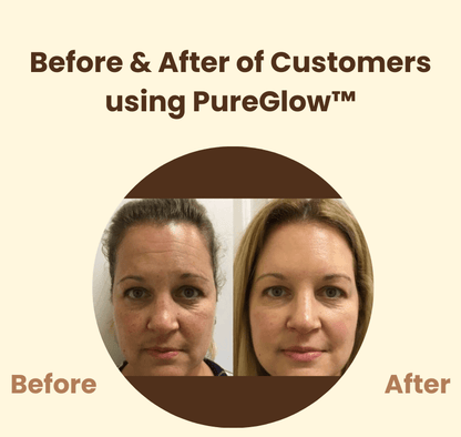 PureGlow™ – Natuurlijke uitstraling en hernieuwd, stralend zelfvertrouwen [50% Korting]