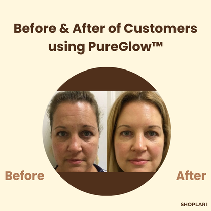 PureGlow™ – Zwarte thee & ginseng tegen acne, rimpels & onzuiverheden voor een stralende huid [1 + 1 Gratis]