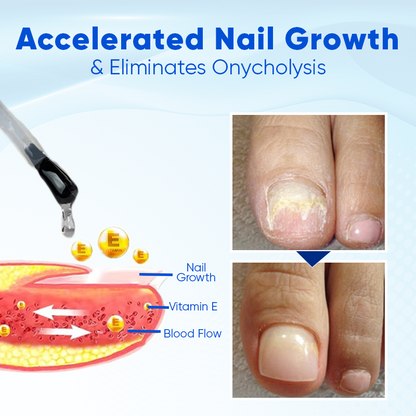 Biancat™ OnyxoGuard Nagelserum – Sterke & Gezonde Nagels [1+1 Gratis]