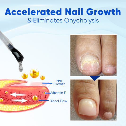 Biancat™ – OnyxoGuard Nagelserum voor Hydratatie & Bescherming van Broze Nagels [1 + 1 Gratis]