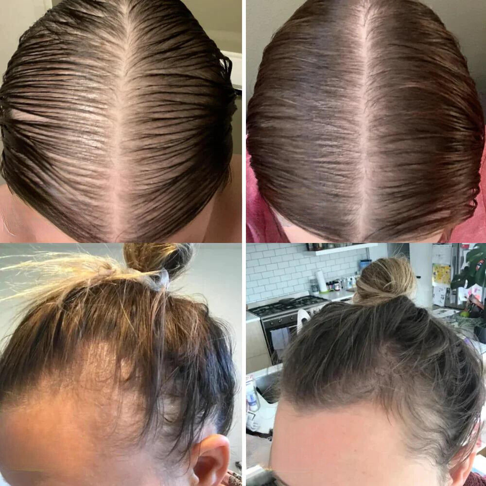 GrowEssence – Natuurlijke haароlie voor krachtig gezond haargroei [50% Korting]