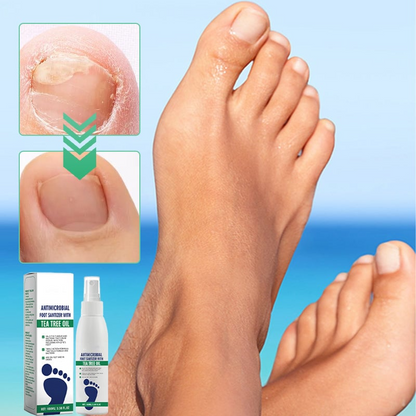 FootCare™ Antimicrobiële Voetspray – Diepe Hydratatie & Voetverzorging [1+1 Gratis]
