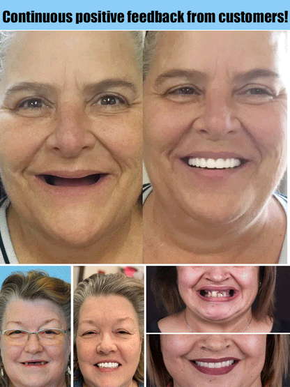 Zahnprothese™ – Natuurlijke glimlach, comfortabele pasvorm & herbruikbaar [50% Korting]