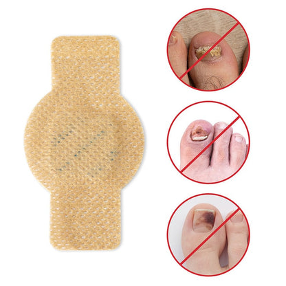 Nailox™ – Voor heldere, gezonde nagels met discrete verzorging de hele dag door [1 + 1 Gratis]