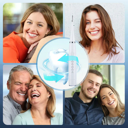 ToothClean – Professionele Tandreiniging voor stralend schone tanden en frisse adem [50% Korting]