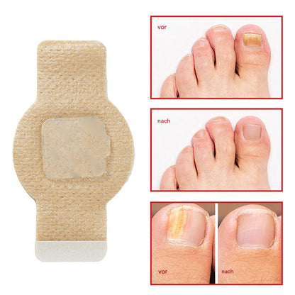 Nailox™ – Voor heldere, gezonde nagels met discrete verzorging de hele dag door [1 + 1 Gratis]