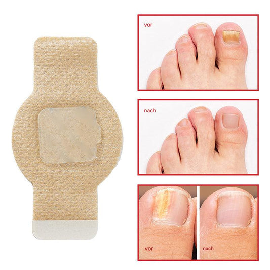 Nailox™ – Voor heldere, gezonde nagels met discrete verzorging de hele dag door [1 + 1 Gratis]