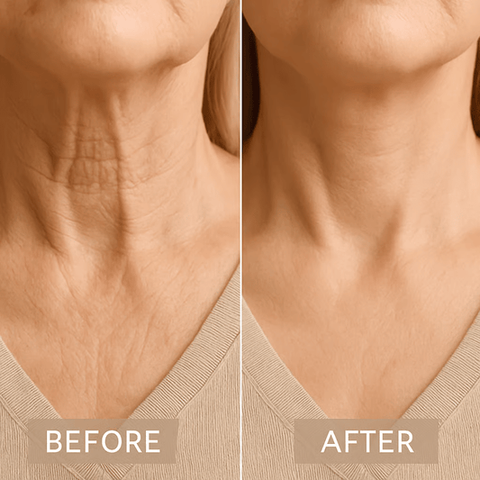 LiftLuxe™ – Instant Nek Tape voor direct strakkere en gladde resultaten [50% Korting]