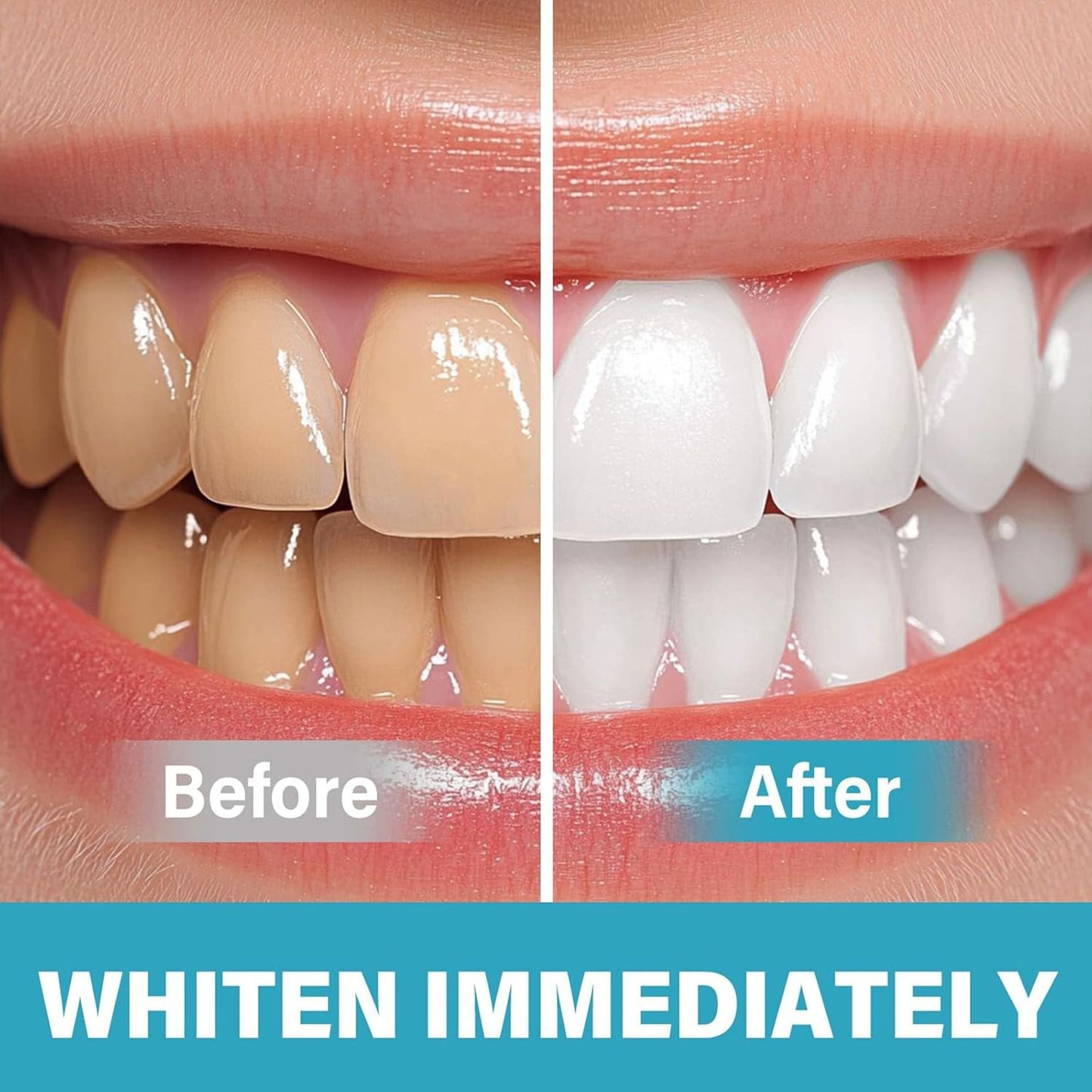 BrightSmile™ – Optische Tandverheldering | Peroxidevrij Tandbleken