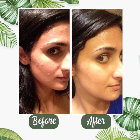 GreenTea™ - Groene thee diep reinigend masker [1 + 1 Gratis]