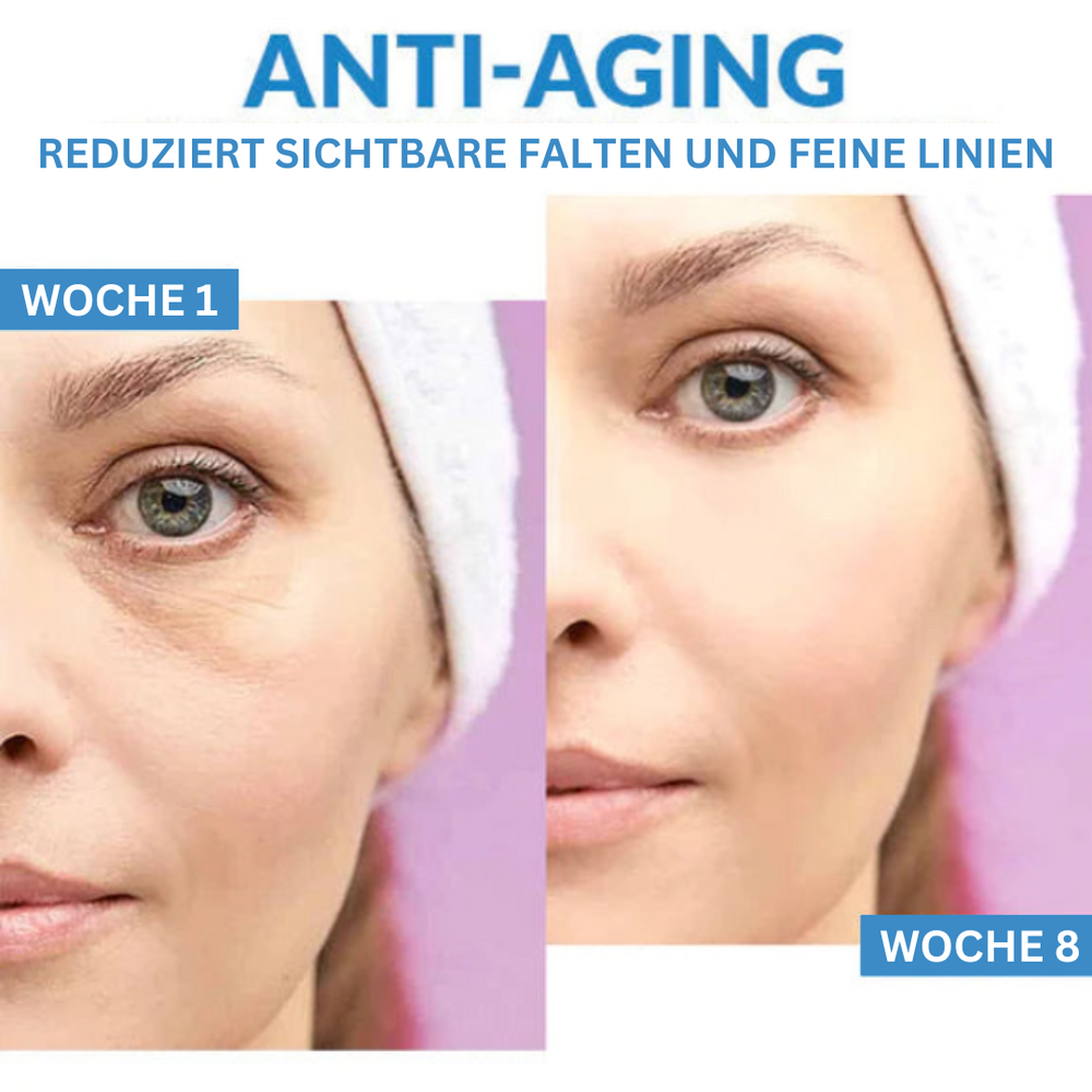 VitaVision™ – Vermoeide ogen direct liften voor een frisse blik [1 + 1 Gratis]