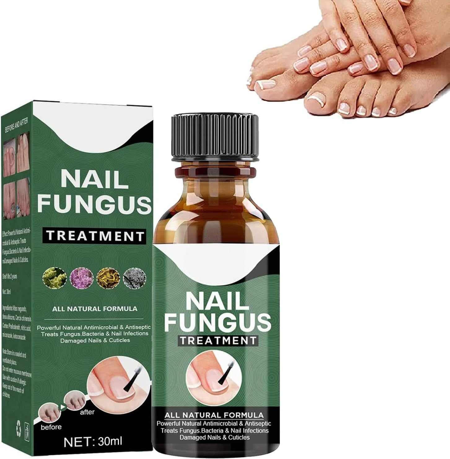 NagelPilz™ – Geneest, herstelt & beschermt beschadigde nagels [50% Korting]