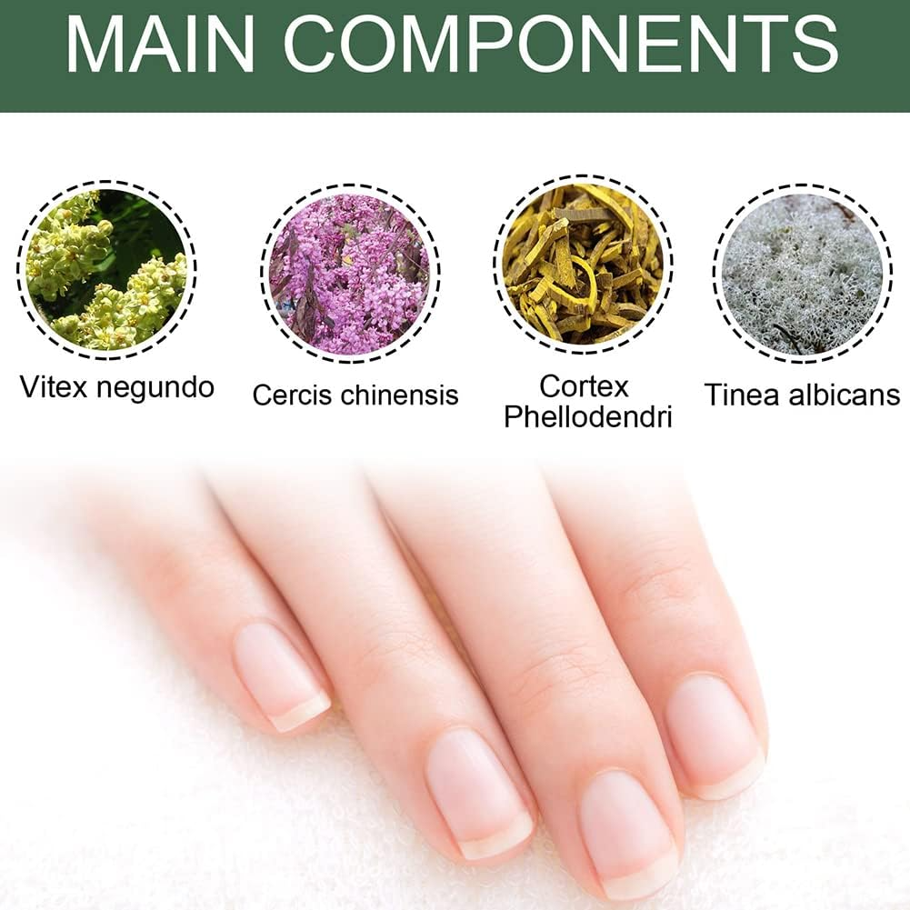 NagelPilz™ – Geneest, herstelt & beschermt beschadigde nagels [50% Korting]