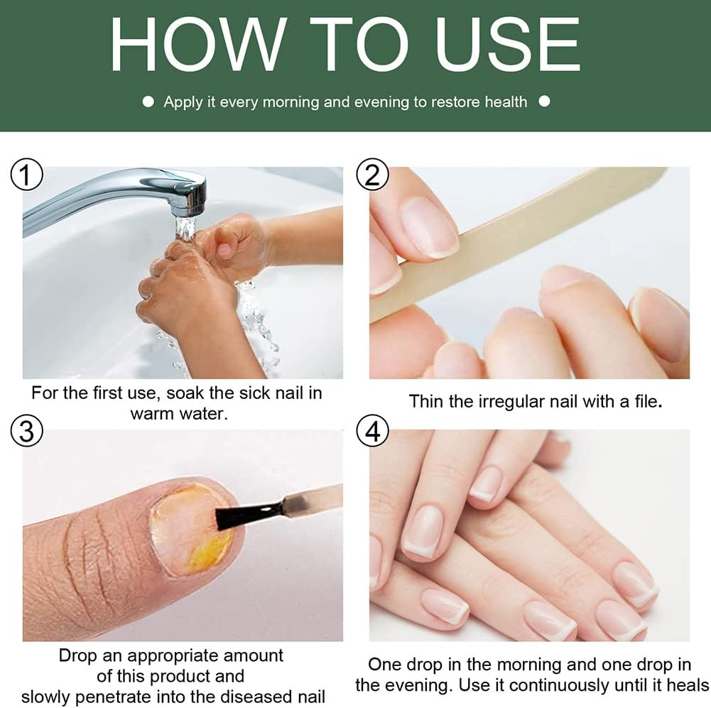 PureNail – Gezonde, verzorgde nagels voor meer zelfvertrouwen [1 + 1 Gratis]