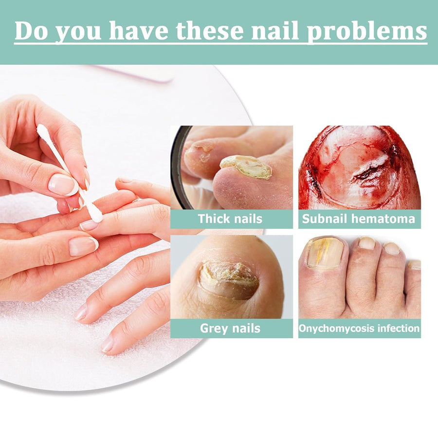VitaNail™ - Natuurlijke nagelverzorgingsstick | Voor gezondere, glanzende nagels [1 + 1 Gratis]