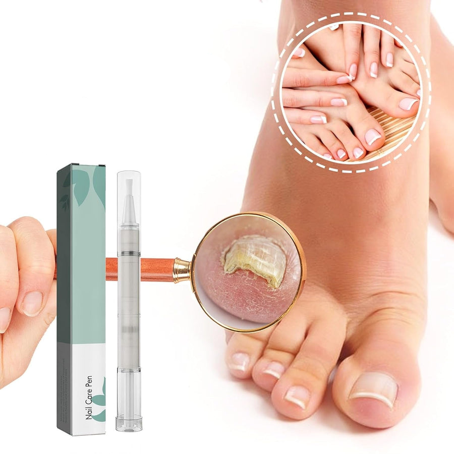 VitaNail™ - Natuurlijke nagelverzorgingsstick | Voor gezondere, glanzende nagels [1 + 1 Gratis]