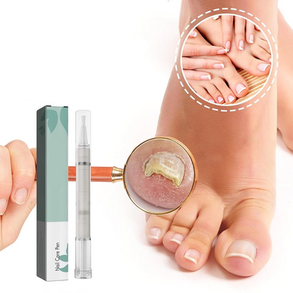 VitaNail™ - Natuurlijke nagelverzorgingsstick | Voor gezondere, glanzende nagels [1 + 1 Gratis]