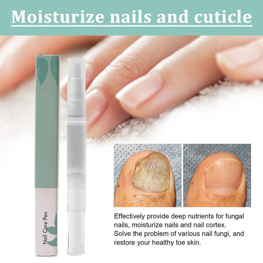 VitaNail™ - Natuurlijke nagelverzorgingsstick | Voor gezondere, glanzende nagels [1 + 1 Gratis]