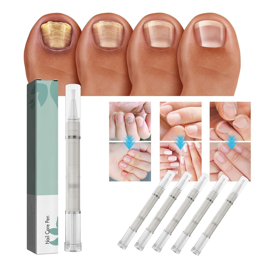 VitaNail™ - Natuurlijke nagelverzorgingsstick | Voor gezondere, glanzende nagels [1 + 1 Gratis]