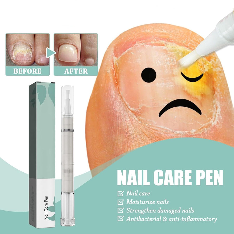 VitaNail™ - Natuurlijke nagelverzorgingsstick | Voor gezondere, glanzende nagels [1 + 1 Gratis]