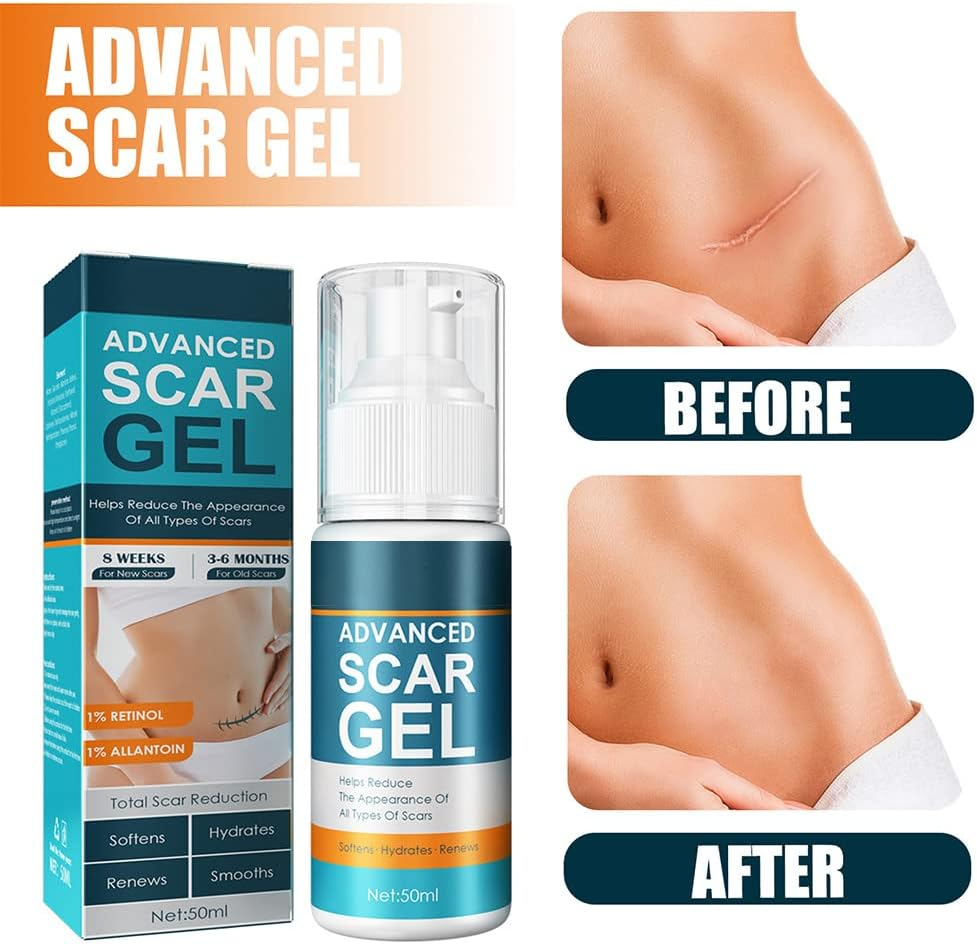 ScarRelief™ – Verzachten, genezen en zacht vernieuwen [1 + 1 Gratis]