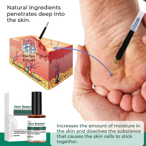 CallusClear™ – Eelt- en likdoornverwijderaar met extra sterke verlichting [1 + 1 Gratis]