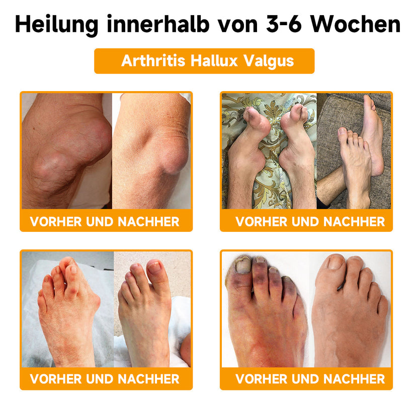 BeeLixir™ – Bijengifcrème met hyaluron & collageen voor intensieve verzorging & regeneratie [1 + 1 Gratis]